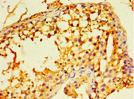 Immunohistochemistry of paraffin-embedded human testis tissue using ECSIT Antibody at dilution of 1:100Rabbit anti-Human ECSIT Polyclonal Antibody