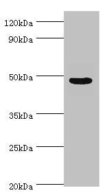Western blot | All lanes: Evolutionarily conserved signaling intermediate in Toll pathway, mitochondrial antibody at 10μg/ml + Jurkat whole cell lysate | Secondary | Goat polyclonal to rabbit IgG at 1/10000 dilution | Predicted band size: 50, 34, 25 kDa | Observed band size: 50 kDaRabbit anti-Human ECSIT Polyclonal Antibody