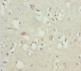 Immunohistochemistry of paraffin-embedded human brain tissue using GAS2L1 Antibody at dilution of 1:100Rabbit anti-Human GAS2L1 Polyclonal Antibody
