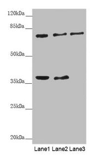 Western blot  | All lanes: GAS2L1 antibody at 0.71µg/ml  | Lane 1: A431 whole cell lysate  | Lane 2: Hela whole cell lysate  | Lane 3: 293T whole cell lysate  | Secondary  | Goat polyclonal to rabbit IgG at 1/10000 dilution  | Predicted band size: 73, 37, 35, 49 kDa  | Observed band size: 73, 37 kDaRabbit anti-Human GAS2L1 Polyclonal Antibody