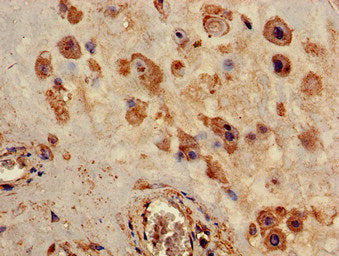 Immunohistochemistry of paraffin-embedded human placenta tissue using P2RX4 Antibody at dilution of 1:100Rabbit anti-Human P2RX4 Polyclonal Antibody