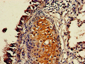Immunohistochemistry of paraffin-embedded human lung tissue using P2RX4 Antibody at dilution of 1:100Rabbit anti-Human P2RX4 Polyclonal Antibody