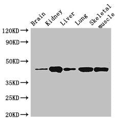 Western Blot | Positive WB detected in: Mouse brain tissue, Mouse kidney tissue, Mouse liver tissue, Rat lung tissue, Rat skeletal muscle tissue | All lanes: P2RX4 antibody at 3μg/ml | Secondary | Goat polyclonal to rabbit IgG at 1/50000 dilution | Predicted band size: 44, 46, 41 kDa | Observed band size: 44 kDaRabbit anti-Human P2RX4 Polyclonal Antibody