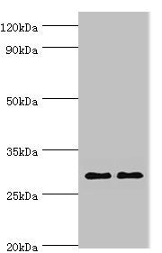 Western blot | All lanes: Spindlin-2B antibody at 4μg/ml | Lane 1: Mouse liver tissue | Lane 2: Mouse heart tissue | Secondary | Goat polyclonal to rabbit IgG at 1/10000 dilution | Predicted band size: 29 kDa | Observed band size: 29 kDaRabbit anti-Human SPIN2B Polyclonal Antibody