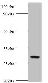 Western blot | All lanes: Spindlin-2B antibody at 4μg/ml + Mouse gastric tissue | Secondary | Goat polyclonal to rabbit IgG at 1/10000 dilution | Predicted band size: 29 kDa | Observed band size: 29 kDaRabbit anti-Human SPIN2B Polyclonal Antibody