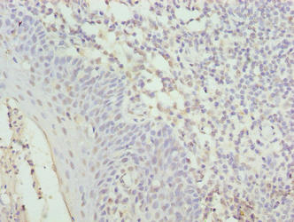 Immunohistochemistry of paraffin-embedded human tonsil tissue using CYBC1 Antibody at dilution of 1:100Rabbit anti-Human CYBC1 Polyclonal Antibody