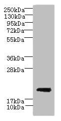 Western blot  | All lanes: CYBC1 antibody at 1.5µg/ml + Mouse liver tissue  | Secondary  | Goat polyclonal to rabbit IgG at 1/10000 dilution  | Predicted band size: 21, 20 kDa  | Observed band size: 21 kDaRabbit anti-Human CYBC1 Polyclonal Antibody