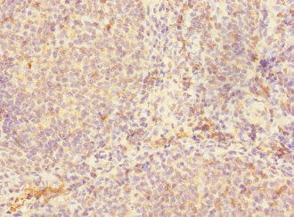 Immunohistochemistry of paraffin-embedded human tonsil tissue using CD180 Antibody at dilution of 1:100Rabbit anti-Human CD180 Polyclonal Antibody