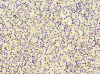 Immunohistochemistry of paraffin-embedded human spleen tissue using CD180 Antibody at dilution of 1:100Rabbit anti-Human CD180 Polyclonal Antibody
