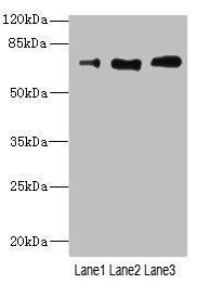 Western blot | All lanes: CD180 antibody at 3.95μg/ml | Lane 1: A549 whole cell lysate | Lane 2: A431 whole cell lysate | Lane 3: HepG2 whole cell lysate | Secondary | Goat polyclonal to rabbit IgG at 1/10000 dilution | Predicted band size: 74 kDa | Observed band size: 74 kDaRabbit anti-Human CD180 Polyclonal Antibody
