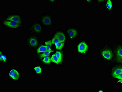 Immunofluorescent analysis of MCF-7 cells using S1PR3 Antibody at dilution of 1:100 and Alexa Fluor 488-congugated AffiniPure Goat Anti-Rabbit IgG(H+L)Rabbit anti-Human S1PR3 Polyclonal Antibody
