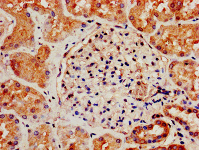 IHC image of the antibody diluted at 1:800 and staining in paraffin-embedded human kidney tissue performed on a Leica BondTM system. After dewaxing and hydration, antigen retrieval was mediated by high pressure in a citrate buffer (pH 6.0). Section was blocked with 10% normal goat serum 30min at RT. Then primary antibody (1% BSA) was incubated at 4°C overnight. The primary is detected by a biotinylated secondary antibody and visualized using an HRP conjugated SP system.Rabbit anti-Human S1PR3 Polyclonal Antibody