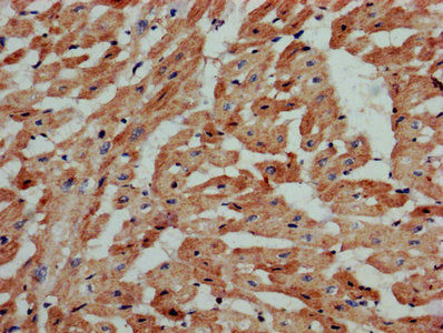 IHC image of S1PR3 Antibody diluted at 1:800 and staining in paraffin-embedded human heart tissue performed on a Leica BondTM system. After dewaxing and hydration, antigen retrieval was mediated by high pressure in a citrate buffer (pH 6.0). Section was blocked with 10% normal goat serum 30min at RT. Then primary antibody (1% BSA) was incubated at 4°C overnight. The primary is detected by a biotinylated secondary antibody and visualized using an HRP conjugated SP system.Rabbit anti-Human S1PR3 Polyclonal Antibody