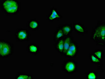 Immunofluorescent analysis of MCF-7 cells using GPER1 Antibody at dilution of 1:100 and Alexa Fluor 488-congugated AffiniPure Goat Anti-Rabbit IgG(H+L)Rabbit anti-Human GPER1 Polyclonal Antibody