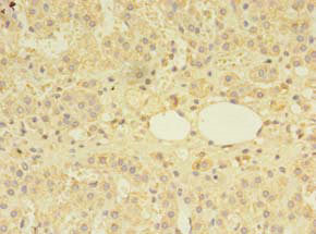 Immunohistochemistry of paraffin-embedded human adrenal gland tissue using the antibody at dilution of 1:100Rabbit anti-Human MTR Polyclonal Antibody