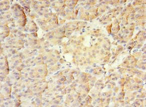 Immunohistochemistry of paraffin-embedded human pancreatic tissue using MTR Antibody at dilution of 1:100Rabbit anti-Human MTR Polyclonal Antibody