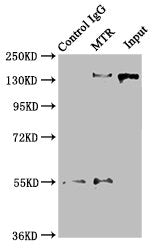 Immunoprecipitating MTR in Hela whole cell lysate  | Lane 1: Rabbit control IgG instead of MTR Antibody in Hela whole cell lysate. For western blotting, a HRP-conjugated Protein G antibody was used as the secondary antibody (1/2000)  | Lane 2: MTR Antibody (8µg) + Hela whole cell lysate (500µg)  | Lane 3: Hela whole cell lysate (10µg)Rabbit anti-Human MTR Polyclonal Antibody