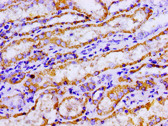 Immunohistochemistry of paraffin-embedded human kidney tissue using ACO2 Antibody at dilution of 1:100