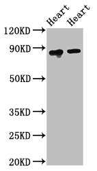 Western Blot | Positive WB detected in: Rat heart tissue, Mouse heart tissue | All lanes: ACO2 antibody at 2.5μg/ml | Secondary | Goat polyclonal to rabbit IgG at 1/50000 dilution | Predicted band size: 86 kDa | Observed band size: 86 kDa