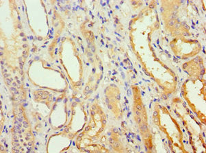 Immunohistochemistry of paraffin-embedded human kidney tissue using AGPAT1 Antibody at dilution of 1:100Rabbit anti-Human AGPAT1 Polyclonal Antibody