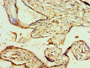 Immunohistochemistry of paraffin-embedded human placenta tissue using AGPAT1 Antibody at dilution of 1:100Rabbit anti-Human AGPAT1 Polyclonal Antibody