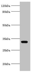 Western blot  | All lanes: AGPAT1 antibody at 6µg/ml + K562 whole cell lysate  | Secondary  | Goat polyclonal to rabbit IgG at 1/10000 dilution  | Predicted band size: 32 kDa  | Observed band size: 32 kDaRabbit anti-Human AGPAT1 Polyclonal Antibody