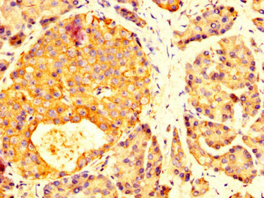 IHC image of MYOC Antibody diluted at 1:200 and staining in paraffin-embedded human pancreatic tissue performed on a Leica BondTM system. After dewaxing and hydration, antigen retrieval was mediated by high pressure in a citrate buffer (pH 6.0). Section was blocked with 10% normal goat serum 30min at RT. Then primary antibody (1% BSA) was incubated at 4°C overnight. The primary is detected by a biotinylated secondary antibody and visualized using an HRP conjugated SP system.Rabbit anti-Human MYOC Polyclonal Antibody