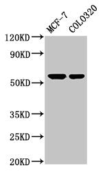 Western Blot  | Positive WB detected in: MCF-7 whole cell lysate, Colo320 whole cell lysate  | All lanes: MYOC antibody at 5.2µg/ml  | Secondary  | Goat polyclonal to rabbit IgG at 1/50000 dilution  | Predicted band size: 57 kDa  | Observed band size: 57 kDaRabbit anti-Human MYOC Polyclonal Antibody