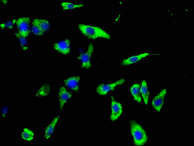 Immunofluorescence staining of HepG2 cells with CSF3R Antibody at 1:100, counter-stained with DAPI. The cells were fixed in 4% formaldehyde, permeabilized using 0.2% Triton X-100 and blocked in 10% normal Goat Serum. The cells were then incubated with the antibody overnight at 4°C. The secondary antibody was Alexa Fluor 488-congugated AffiniPure Goat Anti-Rabbit IgG(H+L).Rabbit anti-Human CSF3R Polyclonal Antibody