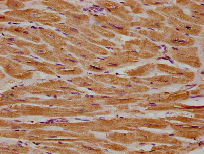 IHC image of the antibody diluted at 1:300 and staining in paraffin-embedded human heart tissue performed on a Leica BondTM system. After dewaxing and hydration, antigen retrieval was mediated by high pressure in a citrate buffer (pH 6.0). Section was blocked with 10% normal goat serum 30min at RT. Then primary antibody (1% BSA) was incubated at 4°C overnight. The primary is detected by a biotinylated secondary antibody and visualized using an HRP conjugated SP system.Rabbit anti-Human CSF3R Polyclonal Antibody
