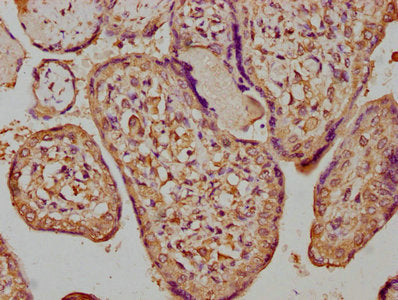 IHC image of CSF3R Antibody diluted at 1:300 and staining in paraffin-embedded human placenta tissue performed on a Leica BondTM system. After dewaxing and hydration, antigen retrieval was mediated by high pressure in a citrate buffer (pH 6.0). Section was blocked with 10% normal goat serum 30min at RT. Then primary antibody (1% BSA) was incubated at 4°C overnight. The primary is detected by a biotinylated secondary antibody and visualized using an HRP conjugated SP system.Rabbit anti-Human CSF3R Polyclonal Antibody