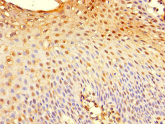 Immunohistochemistry of paraffin-embedded human tonsil tissue using TSC22D3 Antibody at dilution of 1:100Rabbit anti-Human TSC22D3 Polyclonal Antibody