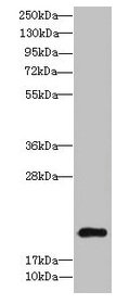 Western blot  | All lanes: TSC22D3 antibody at 9µg/ml + Colo320 whole cell lysate  | Secondary  | Goat polyclonal to rabbit IgG at 1/10000 dilution  | Predicted band size: 15, 23, 14 kDa  | Observed band size: 23 kDaRabbit anti-Human TSC22D3 Polyclonal Antibody