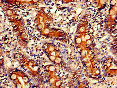 Immunohistochemistry of paraffin-embedded human small intestine tissue using PITX2 Antibody at dilution of 1:100Rabbit anti-Human PITX2 Polyclonal Antibody