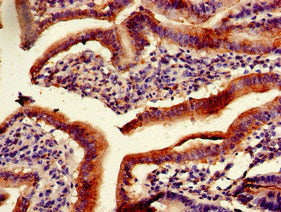 Immunohistochemistry of paraffin-embedded human duodenum tissue using PITX2 Antibody at dilution of 1:100Rabbit anti-Human PITX2 Polyclonal Antibody