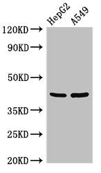 Western Blot  | Positive WB detected in: HepG2 whole cell lysate, A549 whole cell lysate  | All lanes: PITX2 antibody at 3µg/ml  | Secondary  | Goat polyclonal to rabbit IgG at 1/50000 dilution  | Predicted band size: 36, 31 kDa  | Observed band size: 42 kDaRabbit anti-Human PITX2 Polyclonal Antibody