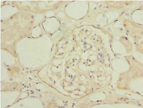 Immunohistochemistry of paraffin-embedded human kidney tissue using NAPG Antibody at dilution of 1:100Rabbit anti-Human NAPG Polyclonal Antibody