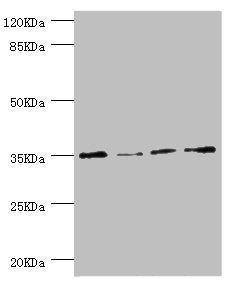 Western blot  | All lanes: NAPG antibody at 1.1µg/ml  | Lane 1: HepG2 whole cell lysate  | Lane 2: Hela whole cell lysate  | Lane 3: U251 whole cell lysate  | Lane 4: K562 whole cell lysate  | Secondary  | Goat polyclonal to rabbit IgG at 1/10000 dilution  | Predicted band size: 35, 26 kDa  | Observed band size: 35 kDaRabbit anti-Human NAPG Polyclonal Antibody