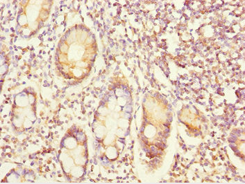 Immunohistochemistry of paraffin-embedded human small intestine tissue using EYA3 Antibody at dilution of 1:100Rabbit anti-Human EYA3 Polyclonal Antibody