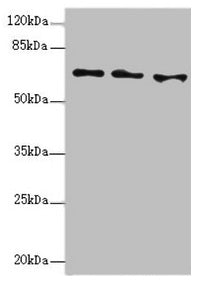 Western blot  | All lanes: EYA3 antibody at 1.49µg/ml  | Lane 1: Hela whole cell lysate  | Lane 2: 293T whole cell lysate  | Lane 3: HT29 whole cell lysate  | Secondary  | Goat polyclonal to rabbit IgG at 1/10000 dilution  | Predicted band size: 63, 49, 59, 57, 58 kDa  | Observed band size: 63 kDaRabbit anti-Human EYA3 Polyclonal Antibody