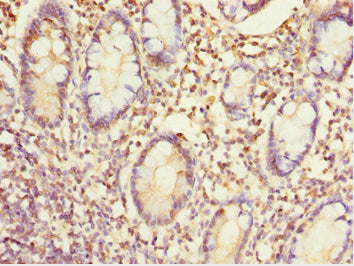 Immunohistochemistry of paraffin-embedded human small intestine tissue using EYA3 Antibody at dilution of 1:100Rabbit anti-Human EYA3 Polyclonal Antibody