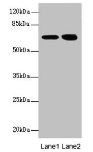 Western blot | All lanes: EYA3 antibody at 2.88μg/ml | Lane 1: Hela whole cell lysate | Lane 2: 293T whole cell lysate | Secondary | Goat polyclonal to rabbit IgG at 1/10000 dilution | Predicted band size: 63, 49, 59, 57, 58 kDa | Observed band size: 63, 67 kDaRabbit anti-Human EYA3 Polyclonal Antibody