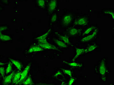 Immunofluorescent analysis of Hela cells using CHP1 Antibody at dilution of 1:100 and Alexa Fluor 488-congugated AffiniPure Goat Anti-Rabbit IgG(H+L)Rabbit anti-Human CHP1 Polyclonal Antibody