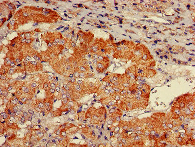 IHC image of CHP1 Antibody diluted at 1:600 and staining in paraffin-embedded human adrenal gland tissue performed on a Leica BondTM system. After dewaxing and hydration, antigen retrieval was mediated by high pressure in a citrate buffer (pH 6.0). Section was blocked with 10% normal goat serum 30min at RT. Then primary antibody (1% BSA) was incubated at 4°C overnight. The primary is detected by a biotinylated secondary antibody and visualized using an HRP conjugated SP system.Rabbit anti-Human CHP1 Polyclonal Antibody