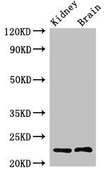 Western Blot | Positive WB detected in: Rat kidney tissue, Mouse brain tissue | All lanes: CHP1 antibody at 2.4μg/ml | Secondary | Goat polyclonal to rabbit IgG at 1/50000 dilution | Predicted band size: 23 kDa | Observed band size: 23 kDaRabbit anti-Human CHP1 Polyclonal Antibody