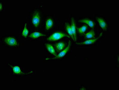 Immunofluorescence staining of A549 cells with HSD17B10 Antibody at 1:133, counter-stained with DAPI. The cells were fixed in 4% formaldehyde, permeabilized using 0.2% Triton X-100 and blocked in 10% normal Goat Serum. The cells were then incubated with the antibody overnight at 4°C. The secondary antibody was Alexa Fluor 488-congugated AffiniPure Goat Anti-Rabbit IgG(H+L).Rabbit anti-Human HSD17B10 Polyclonal Antibody
