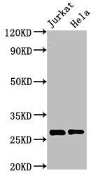 Western Blot  | Positive WB detected in: Jurkat whole cell lysate, Hela whole cell lysate  | All lanes: HSD17B10 antibody at 3µg/ml  | Secondary  | Goat polyclonal to rabbit IgG at 1/50000 dilution  | Predicted band size: 27, 26 kDa  | Observed band size: 27 kDaRabbit anti-Human HSD17B10 Polyclonal Antibody