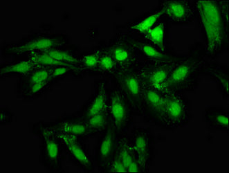 Immunofluorescence staining of Hela cells with NPAS2 Antibody at 1:133, counter-stained with DAPI. The cells were fixed in 4% formaldehyde, permeabilized using 0.2% Triton X-100 and blocked in 10% normal Goat Serum. The cells were then incubated with the antibody overnight at 4°C. The secondary antibody was Alexa Fluor 488-congugated AffiniPure Goat Anti-Rabbit IgG(H+L).Rabbit anti-Human NPAS2 Polyclonal Antibody