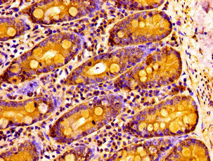 IHC image of NPAS2 Antibody diluted at 1:100 and staining in paraffin-embedded human small intestine tissue performed on a Leica BondTM system. After dewaxing and hydration, antigen retrieval was mediated by high pressure in a citrate buffer (pH 6.0). Section was blocked with 10% normal goat serum 30min at RT. Then primary antibody (1% BSA) was incubated at 4°C overnight. The primary is detected by a biotinylated secondary antibody and visualized using an HRP conjugated SP system.Rabbit anti-Human NPAS2 Polyclonal Antibody