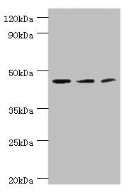 Western blot  | All lanes: ACY1 antibody at 4µg/ml  | Lane 1: K562 whole cell lysate  | Lane 2: HepG2 whole cell lysate  | Lane 3: Mouse kidney tissue  | Secondary  | Goat polyclonal to rabbit IgG at 1/10000 dilution  | Predicted band size: 46, 38, 39, 43 kDa  | Observed band size: 46 kDaRabbit anti-Human ACY1 Polyclonal Antibody